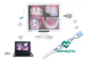 Интраоральная камера беспроводная многофункциональная TPC AIC 333 wireless (Медицинский монитор 17" в комплекте)