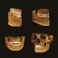 Томограф GENORAY Papaya 3D 16x14