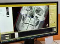 Компьютерный томограф NewTom Giano HR Advanced 13x16 с цефалостатом