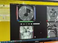 Компьютерный томограф NewTom Giano HR Professional 16x18 с цефалостатом