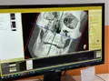 Компьютерный томограф NewTom Giano HR Professional 16x18 с цефалостатом